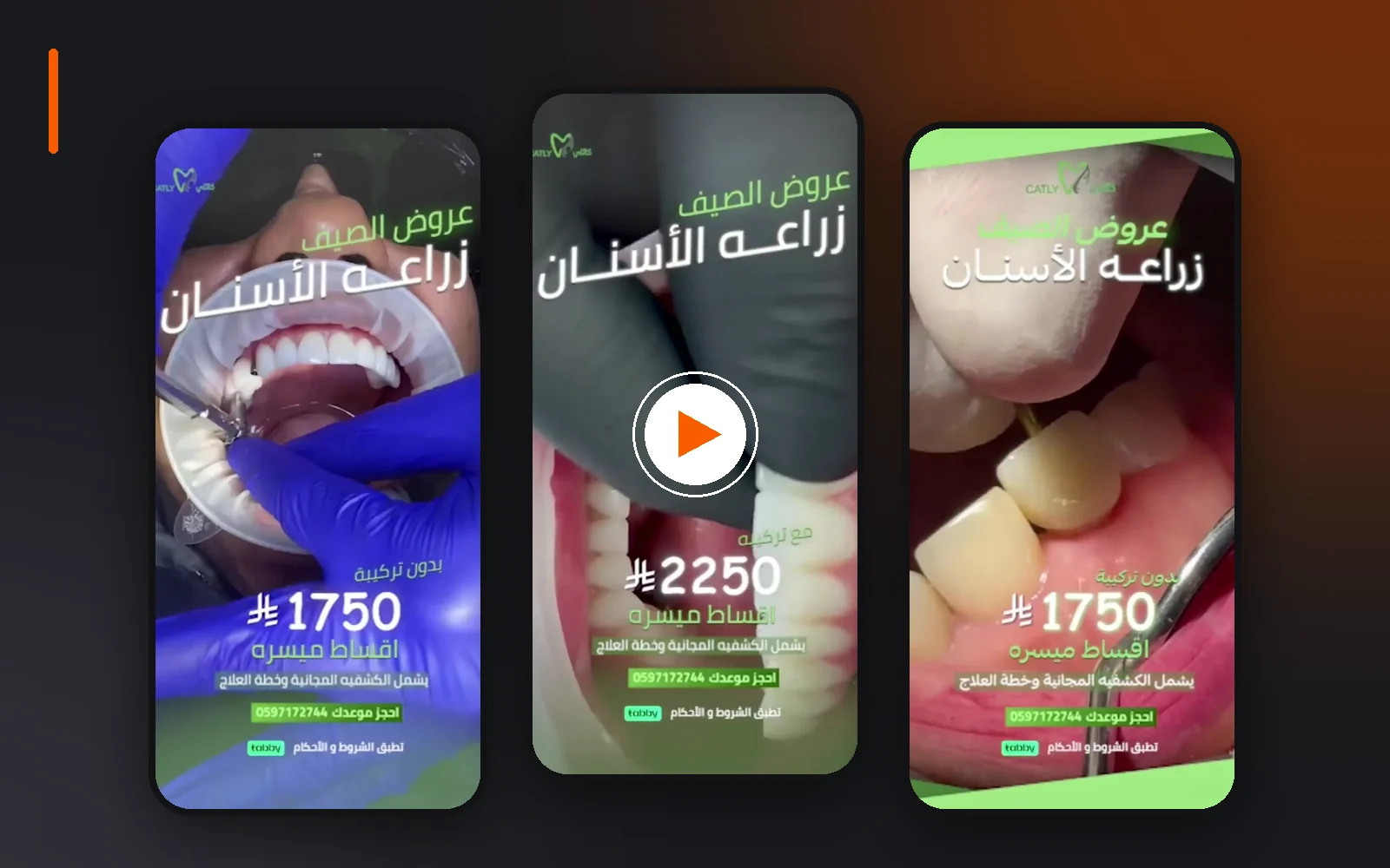 عيادات الأفضل — ريلز تيك توك وإنستقرام (قبل/بعد وابتسامة هوليود)